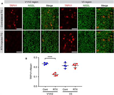 Corrigendum: TRPV1 and TRPV1-Expressing Nociceptors Mediate Orofacial Pain Behaviors in a Mouse Model of Orthodontic Tooth Movement